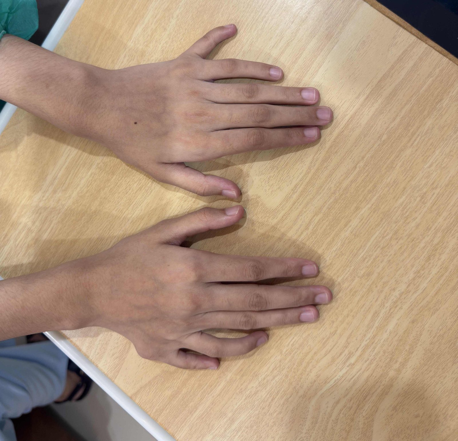 Before